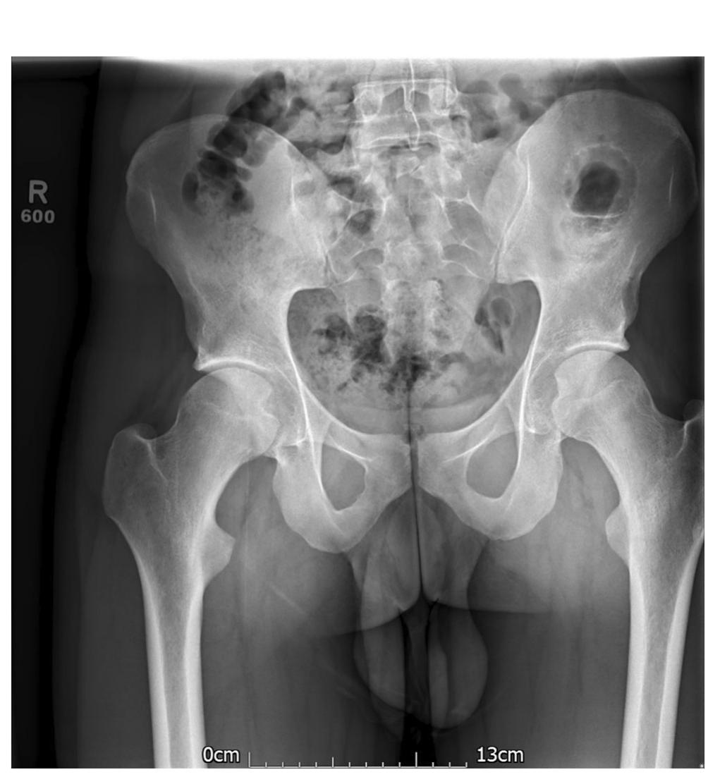 Ap radiograph of the pelvis author contribution statement