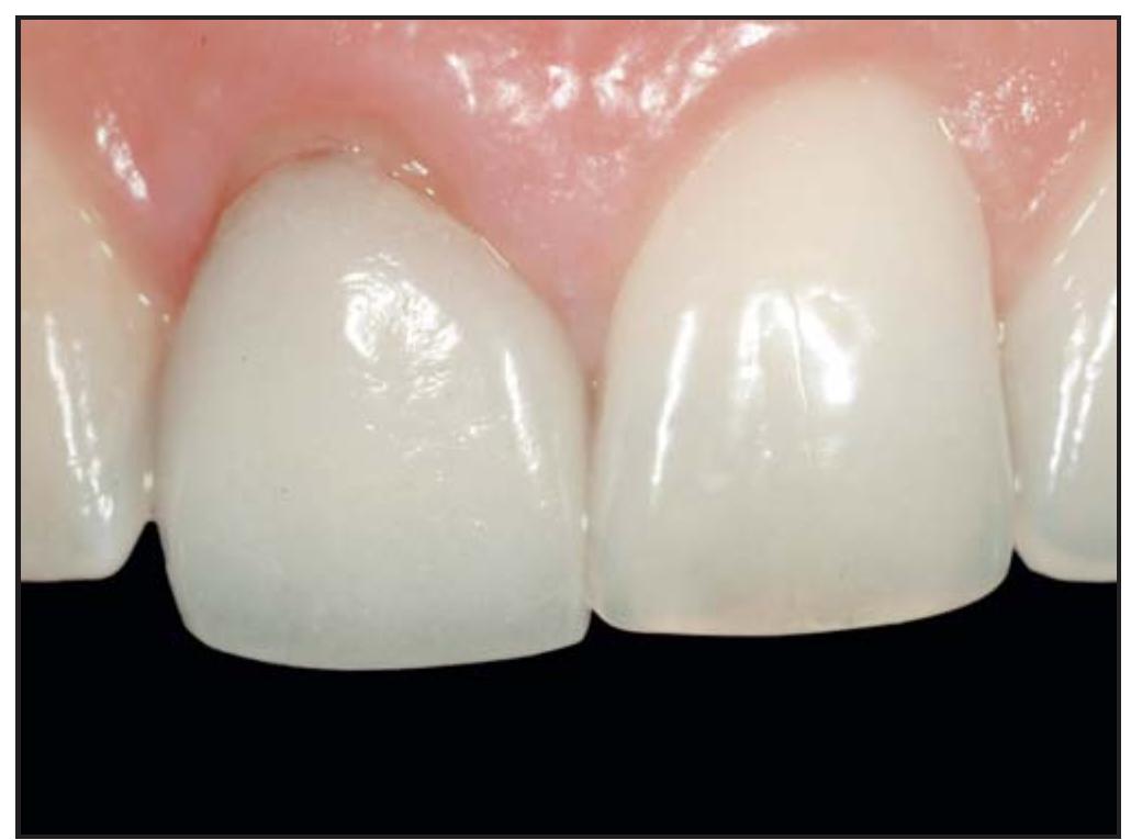 Figure 2 - from A simplified socket classification and