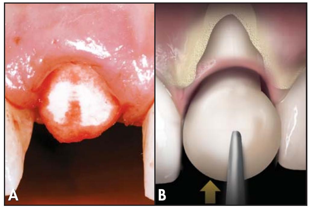 Figure 2 - from A simplified socket classification and