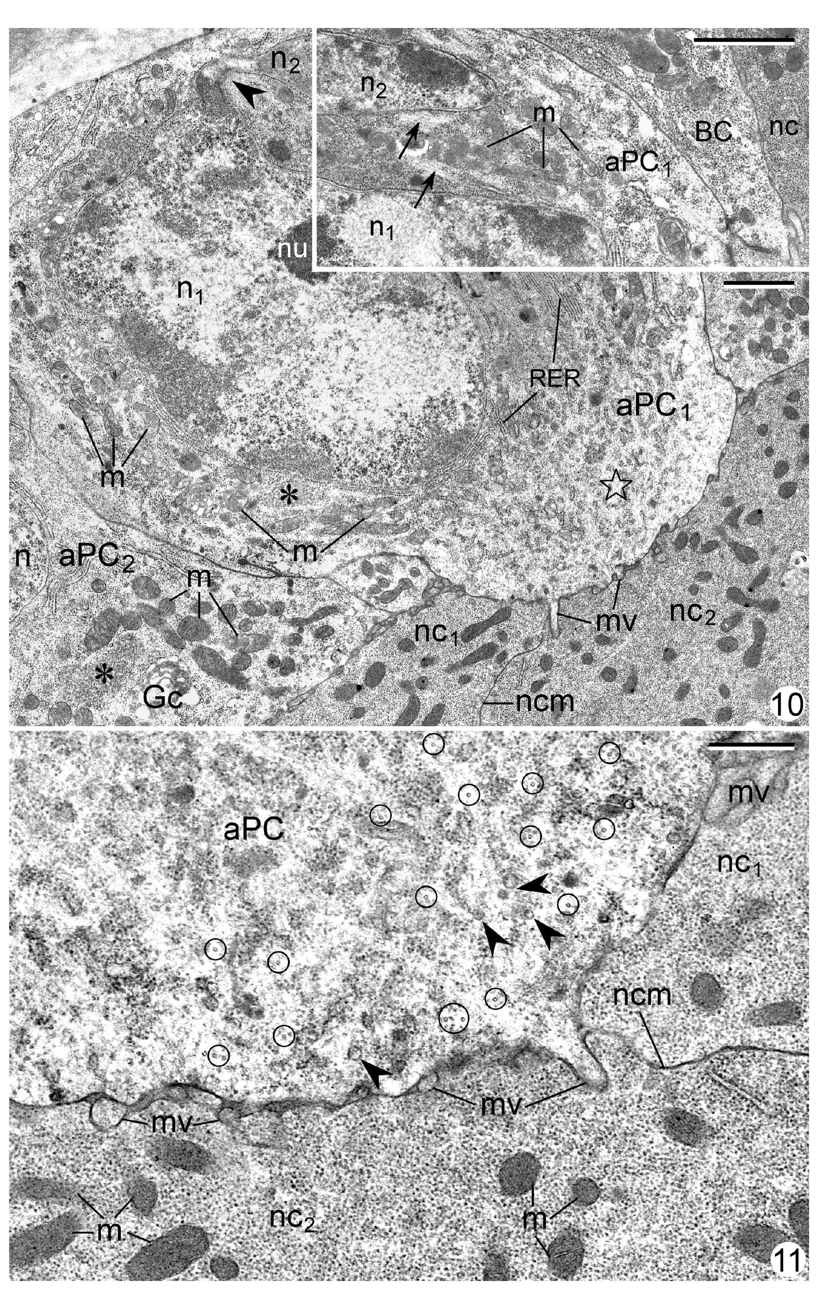 S 10-11. fig. 10. the ultrastructure of the anterior p/bc