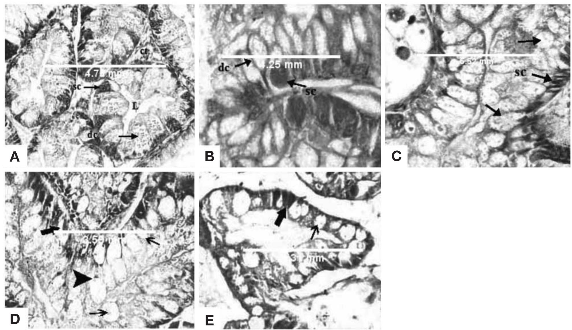 (PDF) Effect of Cestrum diurnum and Casimiroa edulis plants on the ...