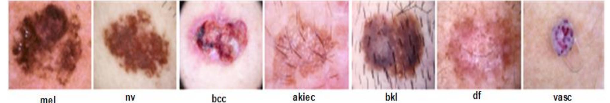 Figure 1 - from Multiclass Skin Lesion Classification Using