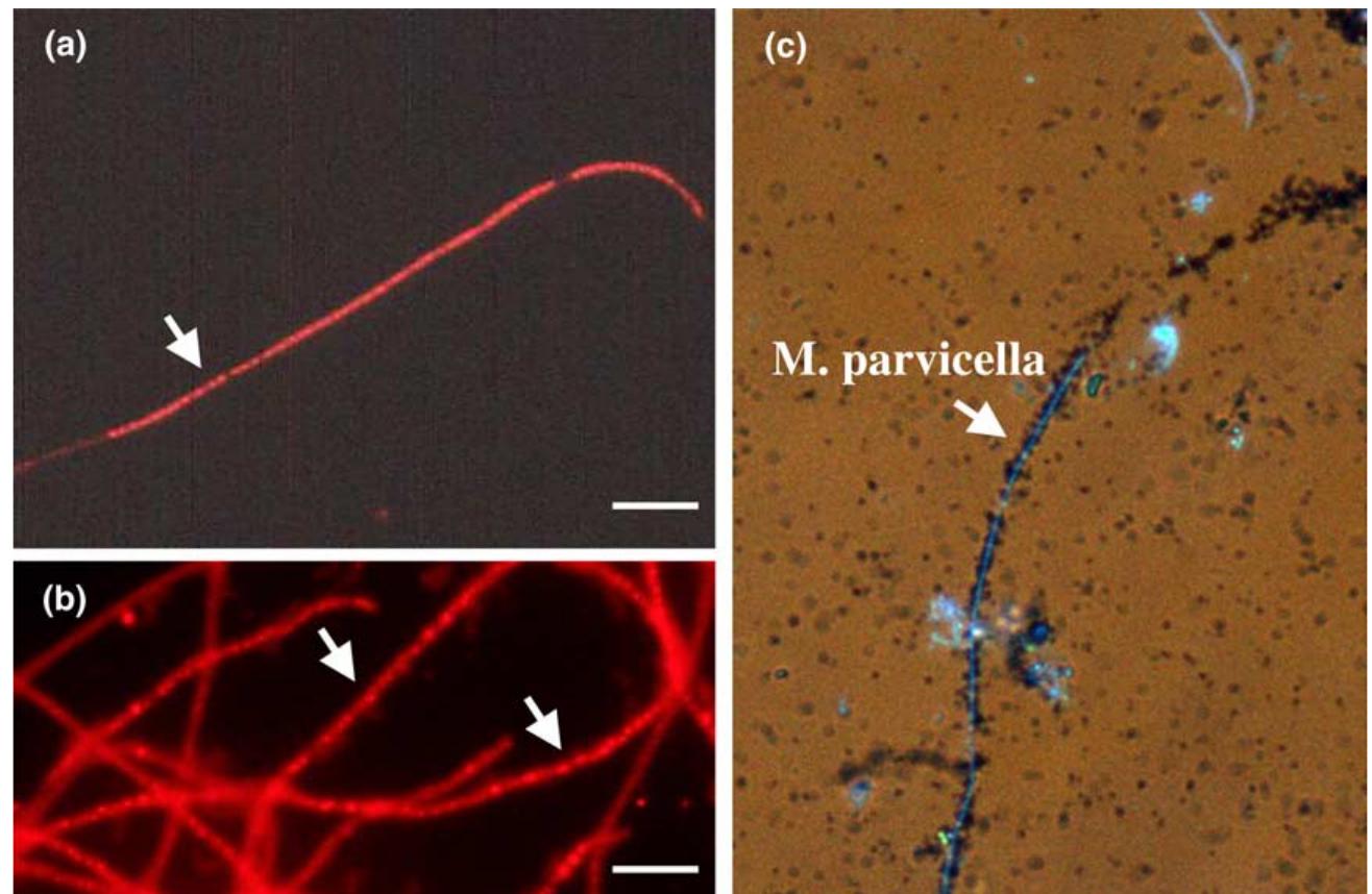Microthrix Examples Figure 4 - from “Microthrix parvicella”, a filamentous