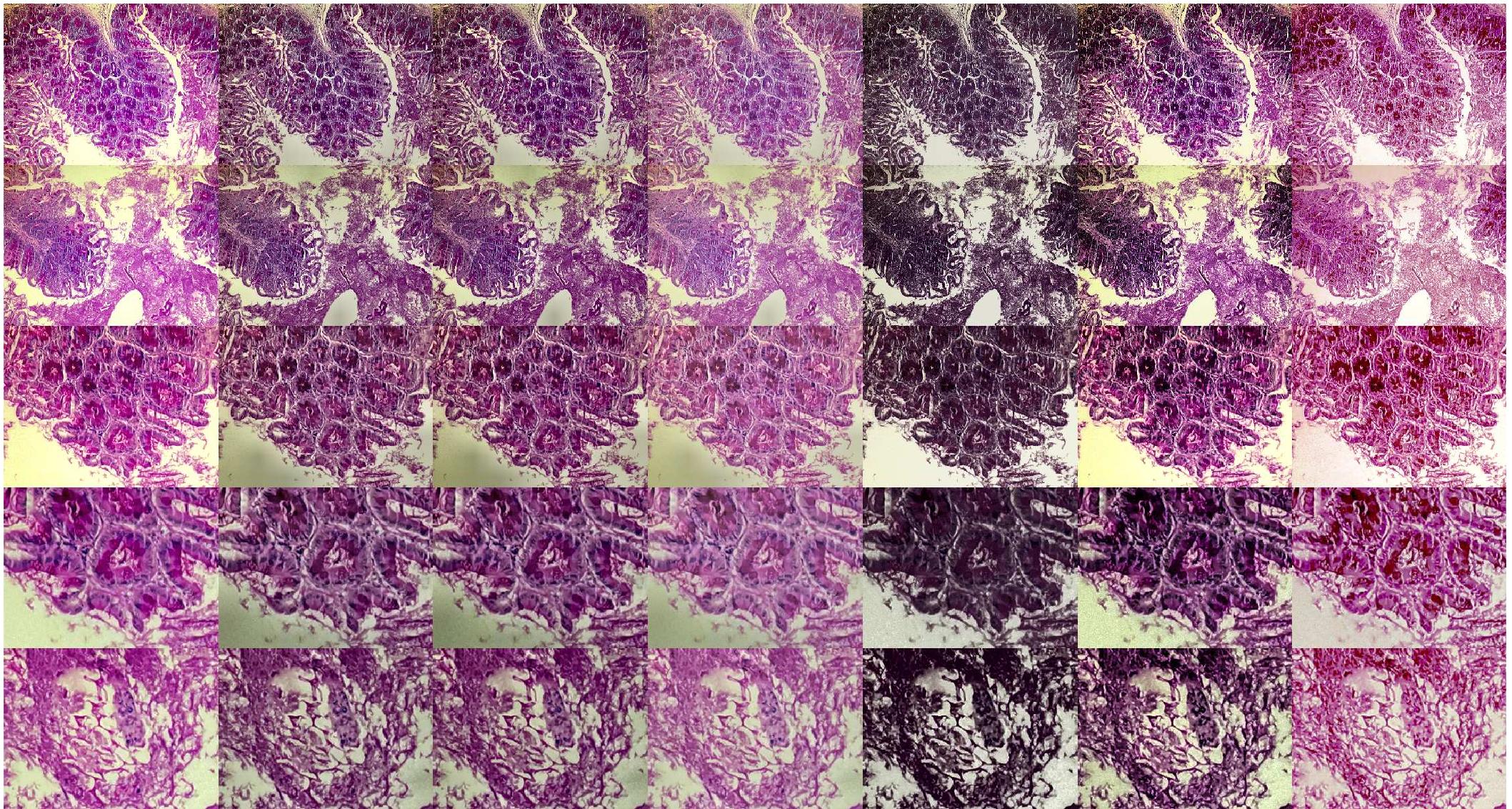 (PDF) Microscale Image Enhancement Via PCA and Well-Exposedness Maps