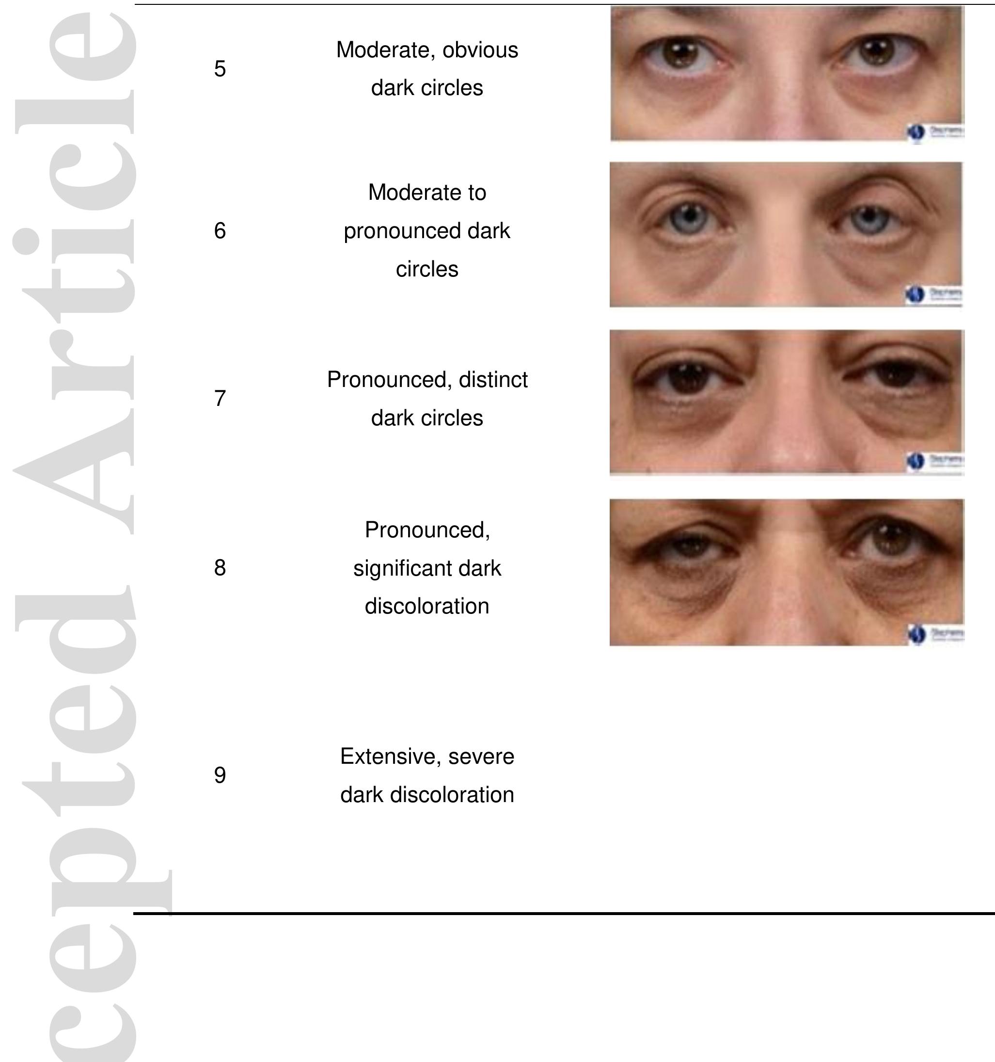 (PDF) A validated photonumeric scale for infraorbital dark circles and ...