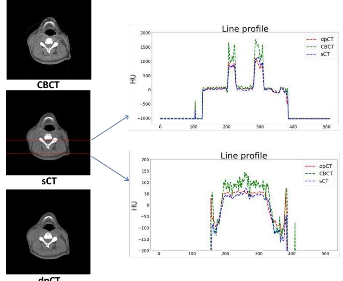 The left row illustrates an example of cbct image, sct image