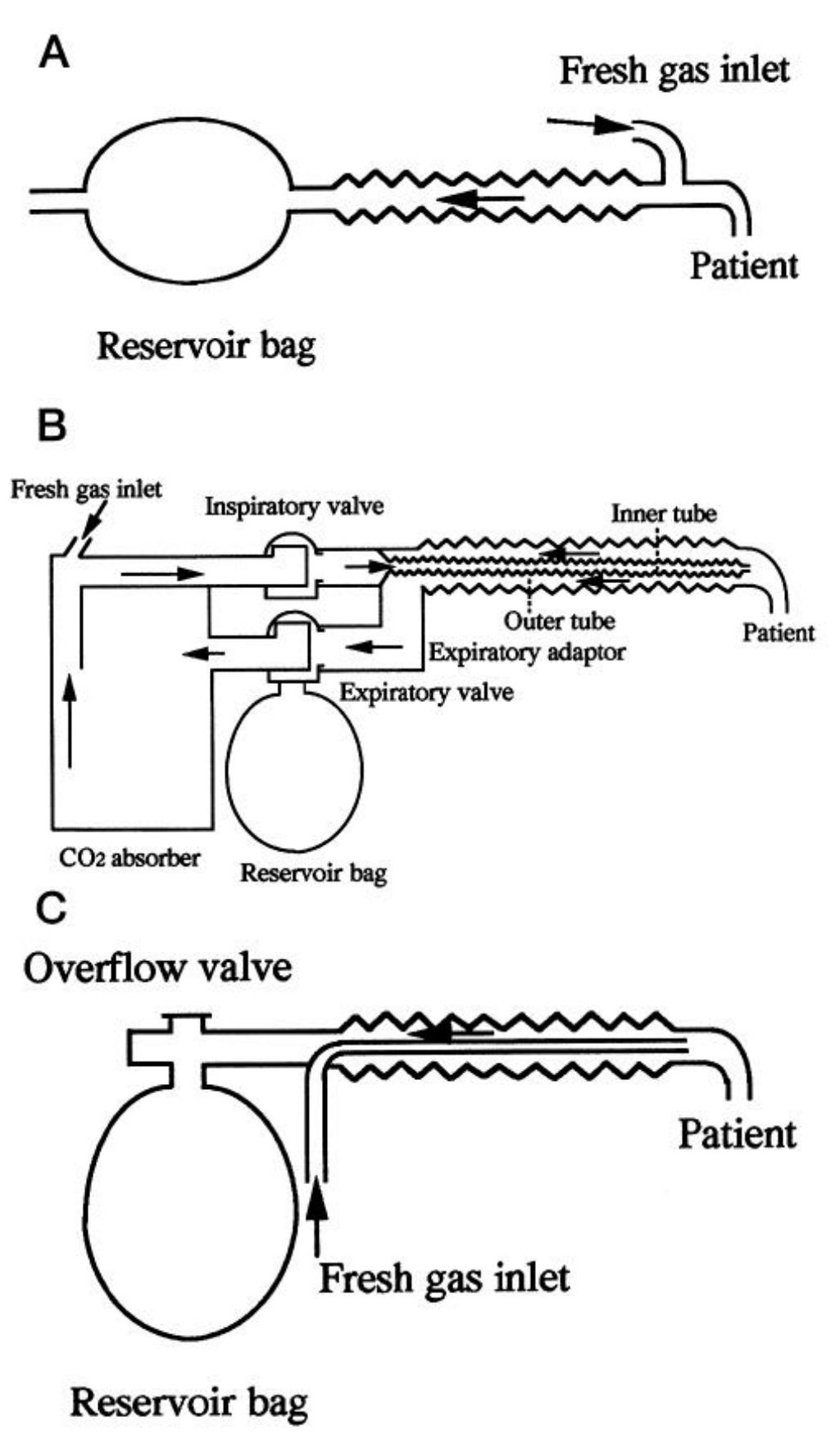 (PDF) Comparison of the Jackson-Rees Circuit, the Pediatric Circle, and ...