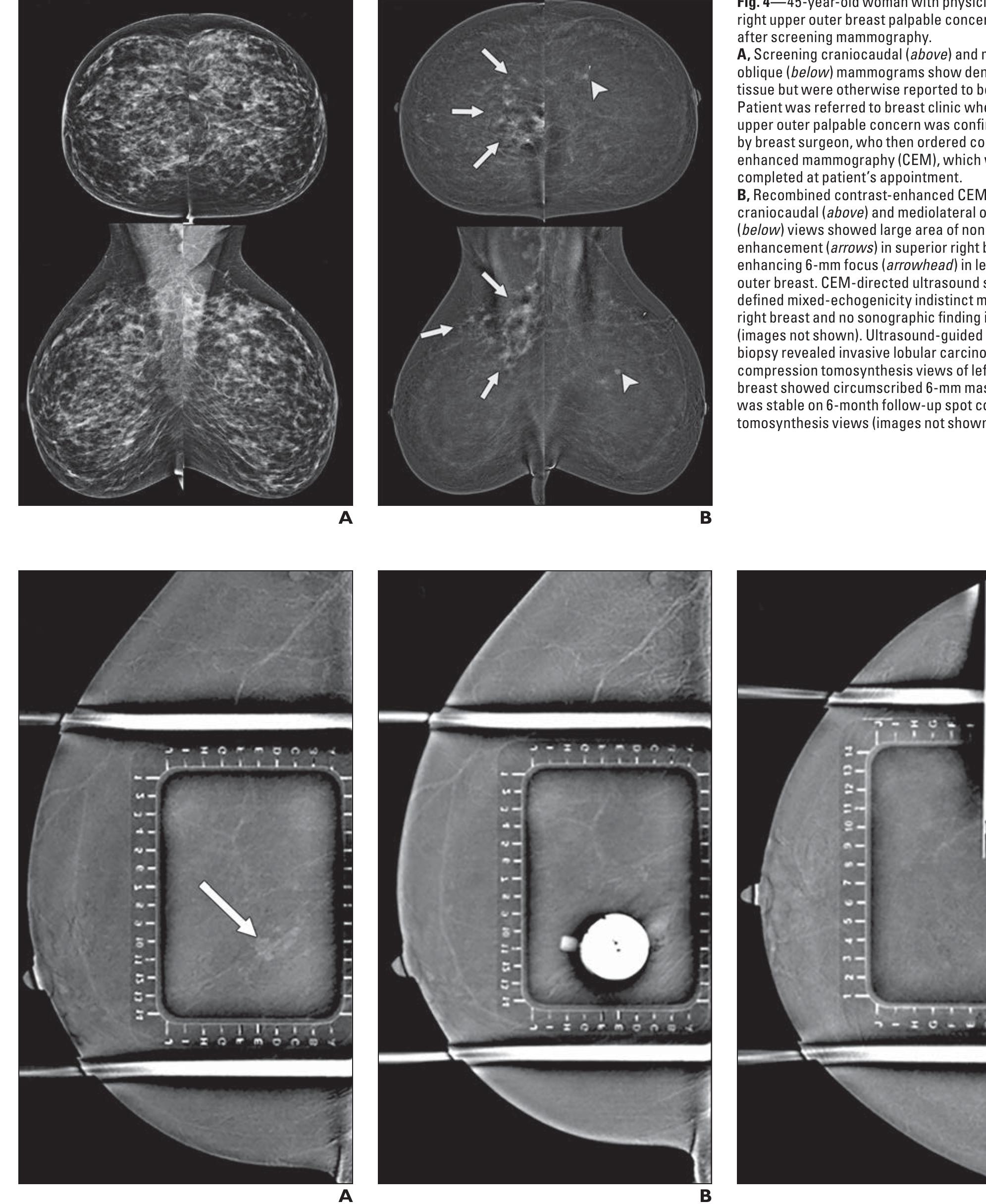(PDF) The Future of Contrast-Enhanced Mammography