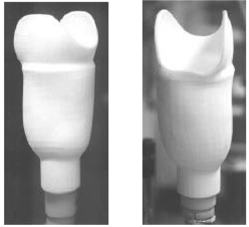 Figure 10. Front-right and rear views of the completed socket.  After the socket was fabricated, a pre-fitting process was to shape the top of the socket and to attach the pylon and prosthetic foot. After these steps were completed the socket was fitted to the patient, which included checking the actual socket fit and the alignment of the pylon on the bottom of the socket. Once the socket was properly fitted, a clinical test was performed to better evaluate its performance in walking activities. The final socket is shown in Figure 10 after  this prefitting process. 