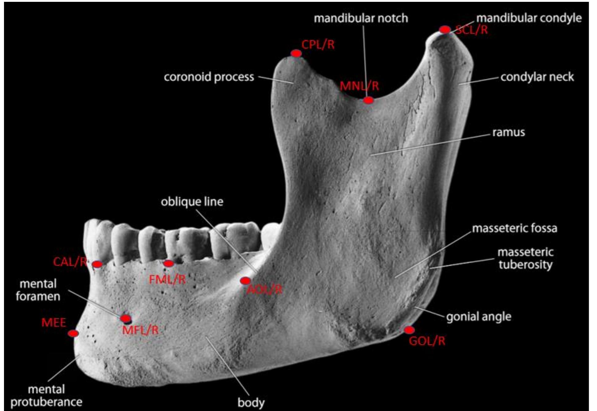 Lr Mandibular Ridge B.18. mandible, lateral; photograph adapted from white et