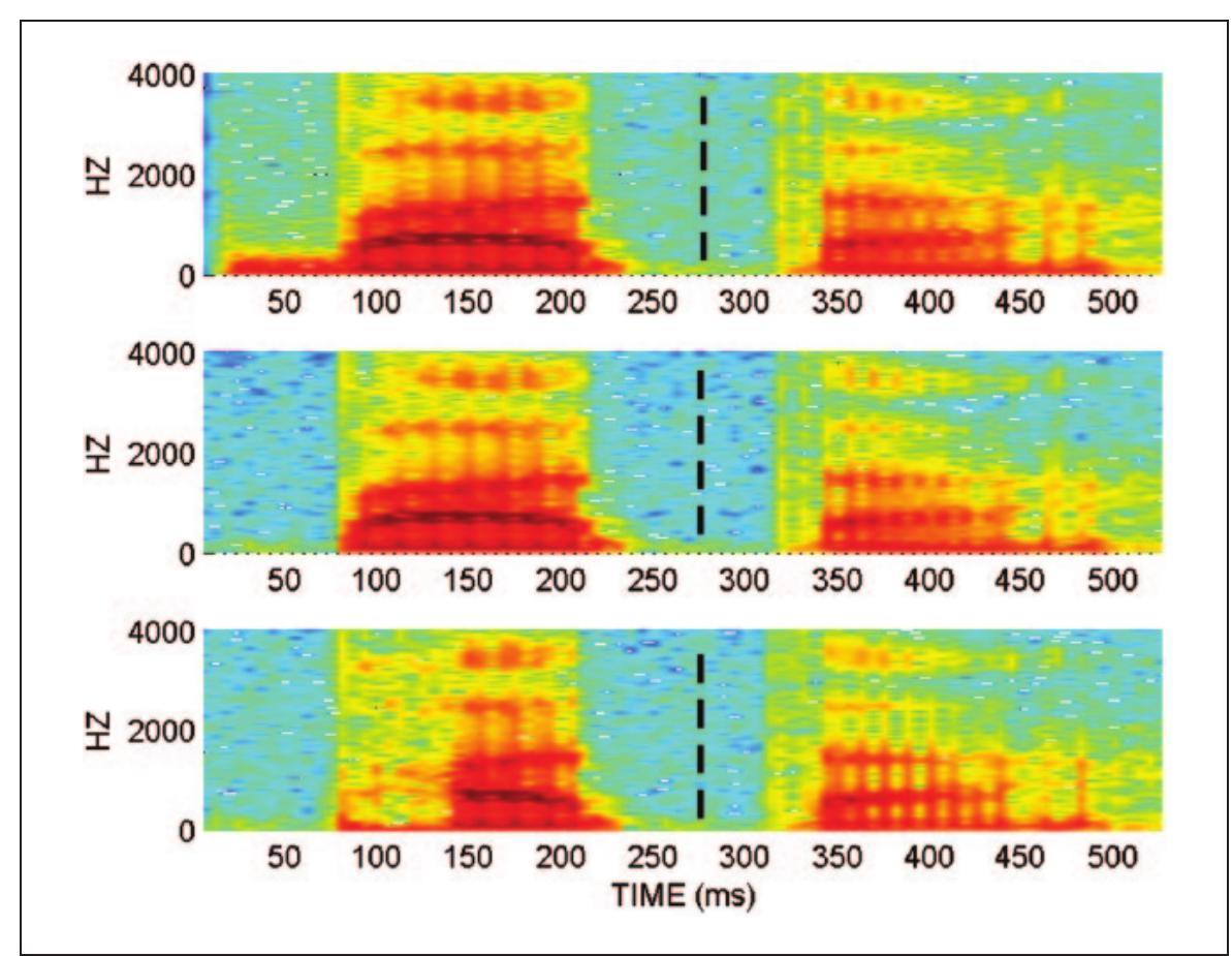 Vot Spectrogram |. samples of edited tokens of bata and pata with voice