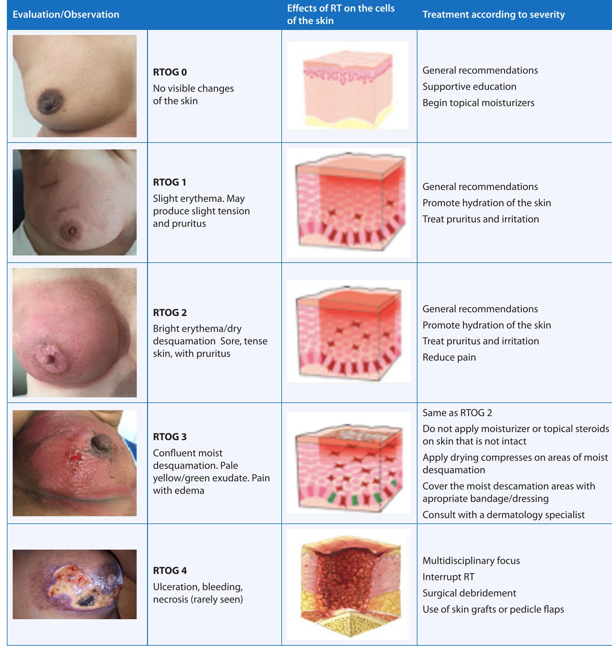 Rt Classification Rt — radiation therapy table 4. radiation therapy oncology