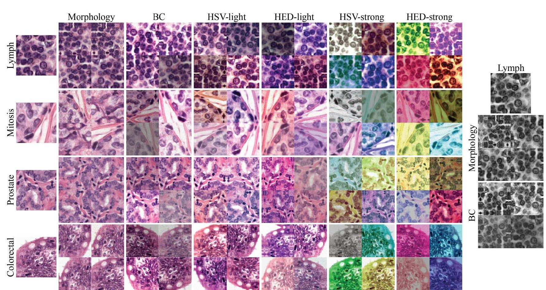 (PDF) Quantifying the effects of data augmentation and stain color ...