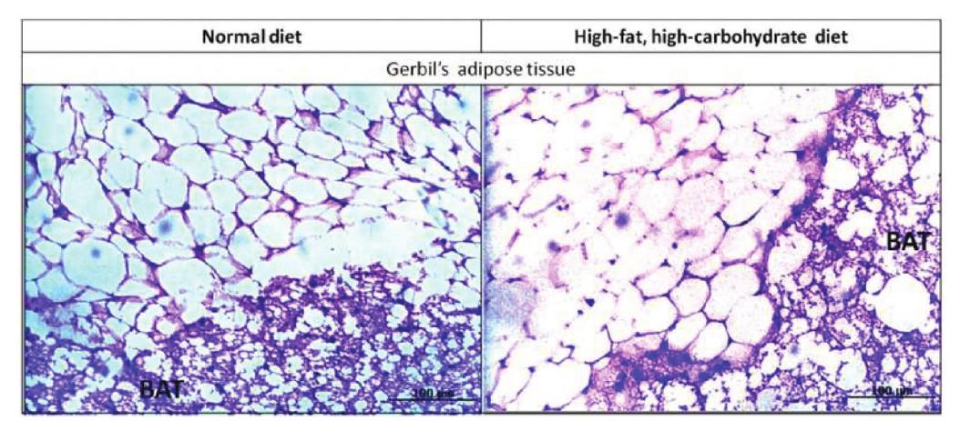 PDF) Predictors of weight gain during the COVID-19 quarantine: The