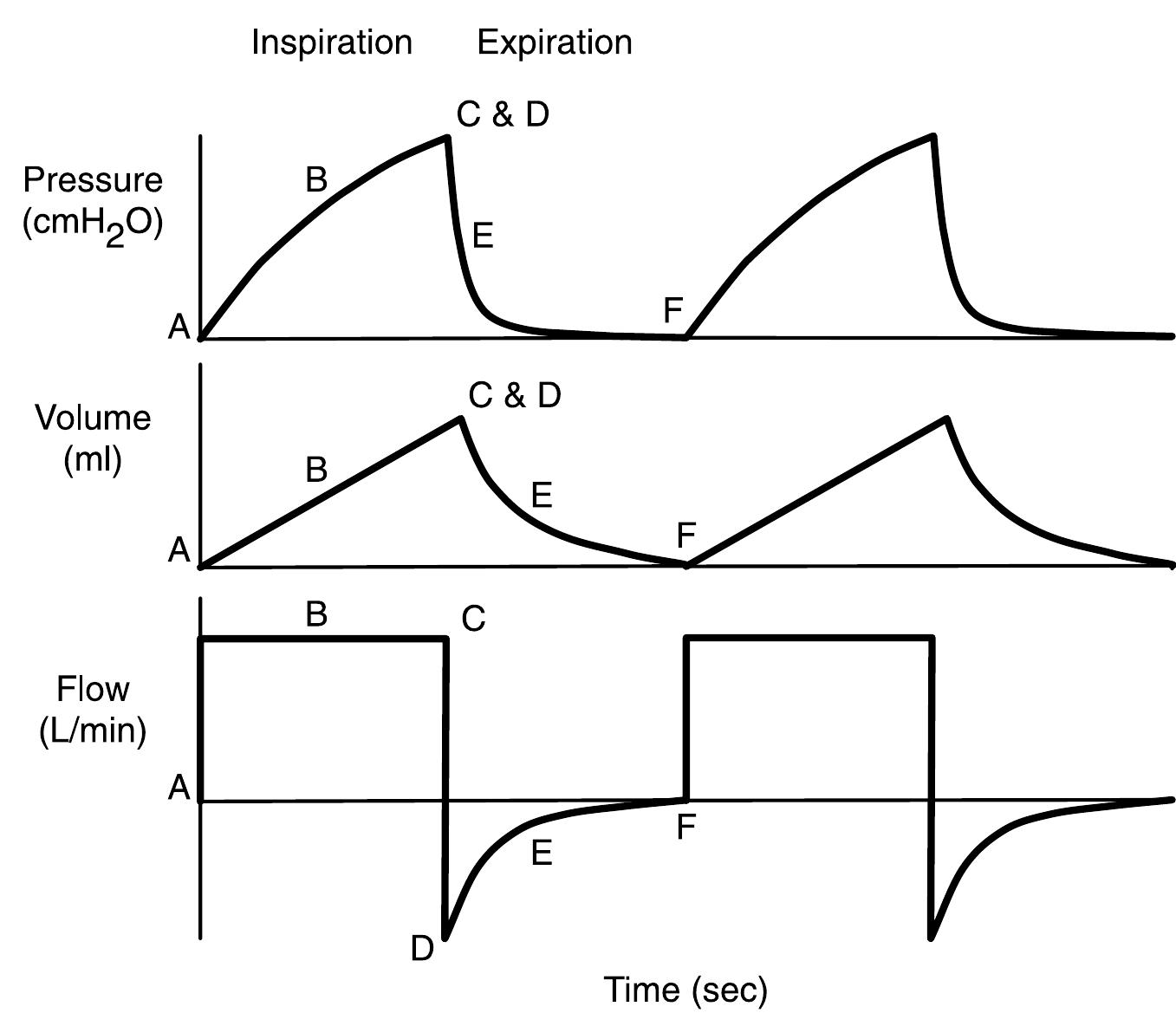 Figure 4 - from Ventilator waveform interpretation in