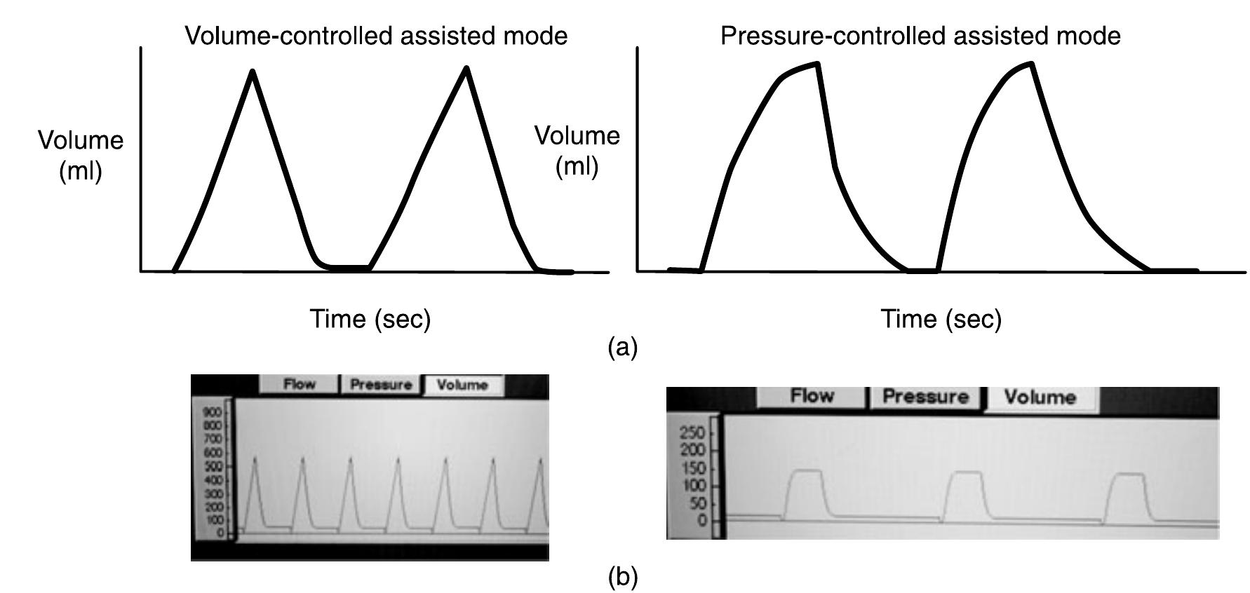 (PDF) Ventilator waveform interpretation in mechanically ventilated ...