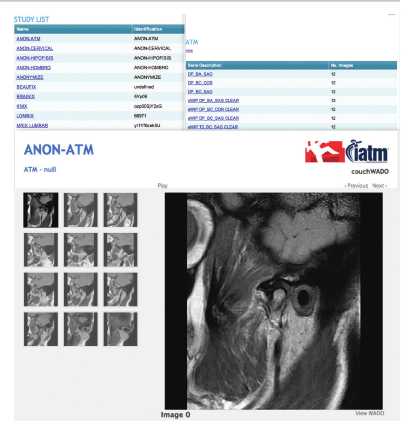 (PDF) Informatics in Radiology: Use of CouchDB for Document-based ...