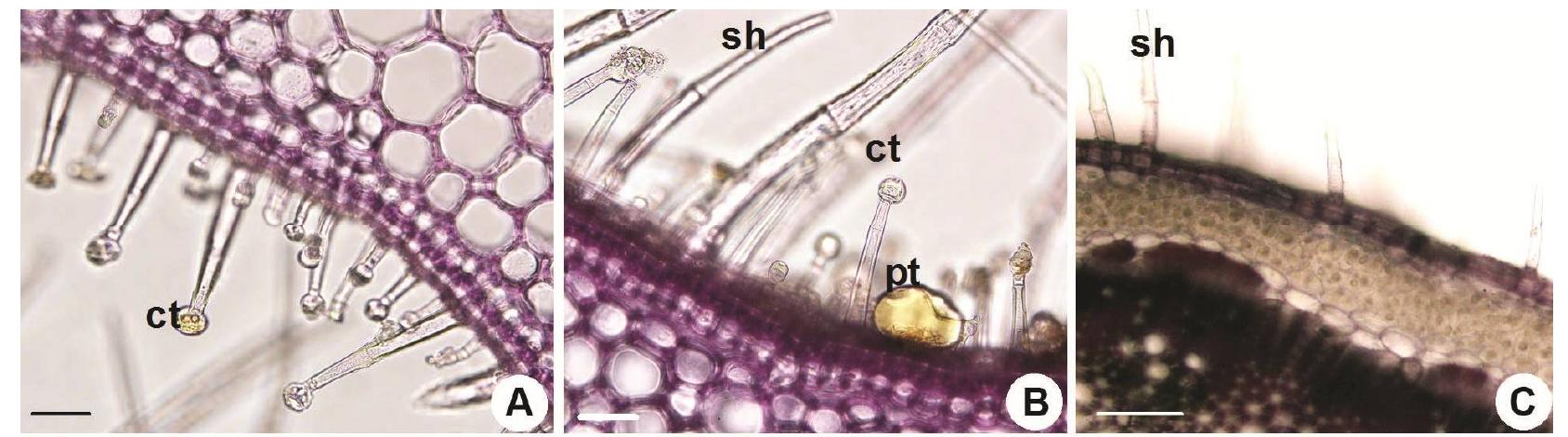 Fig. 6. Some trichomes from different parts of Salvia divaricata subsp. artvinense. A-B. petiole. C. stem Scale bar: 100 um. 