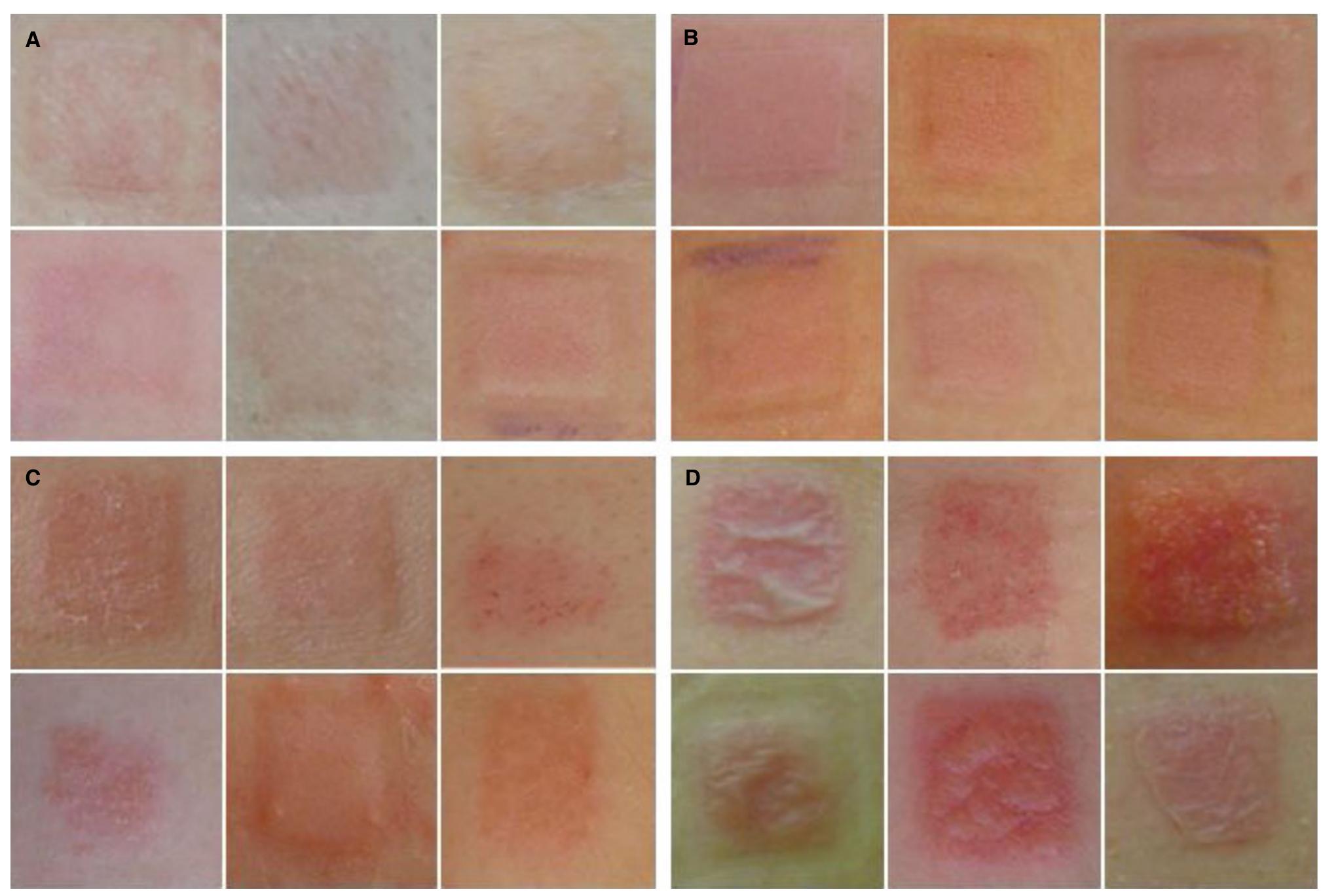 Figure 1 - from Primary irritation index and safety zone of