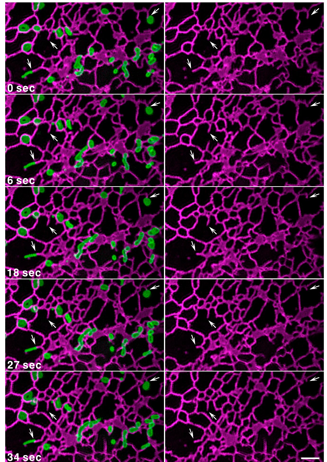 Figure 14 - from Visualizing Intracellular Organelle and