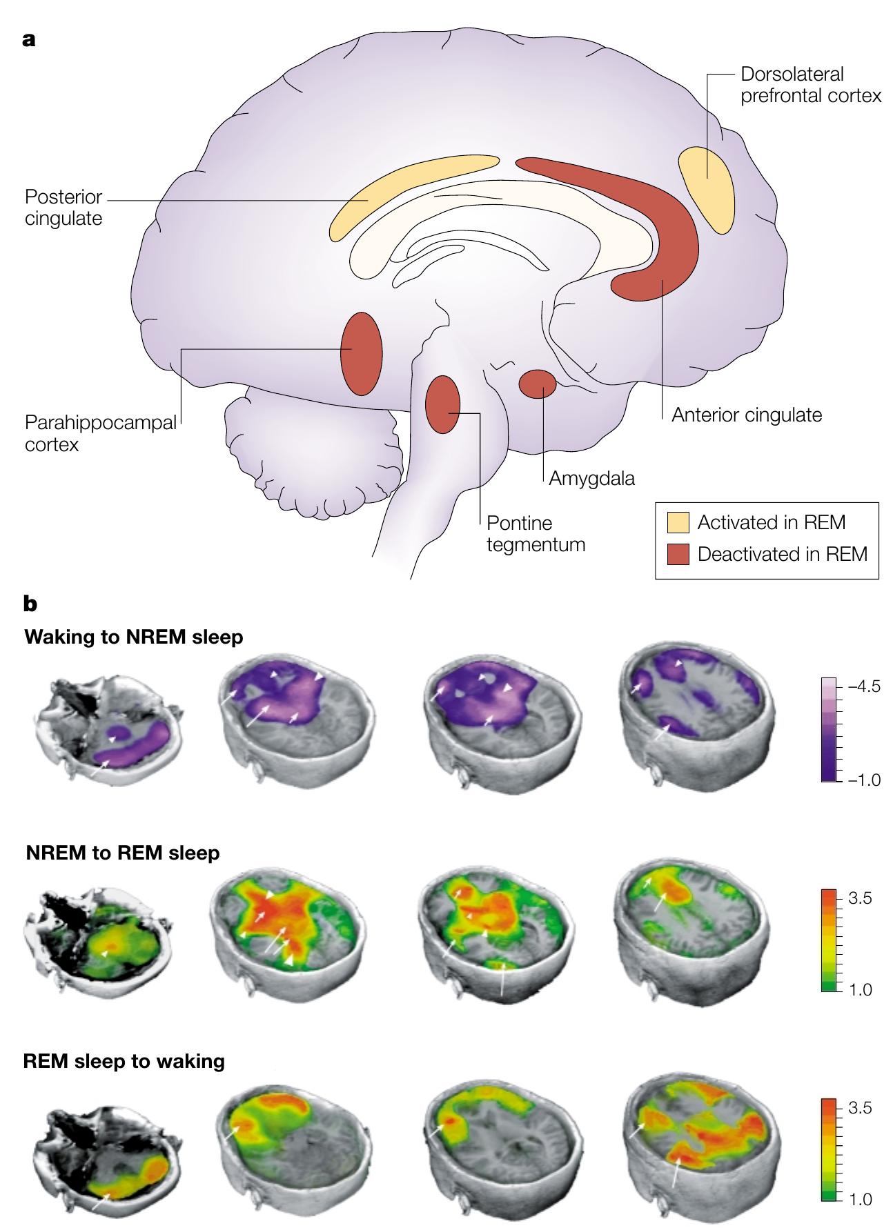 (PDF) The cognitive neuroscience of sleep: neuronal systems ...