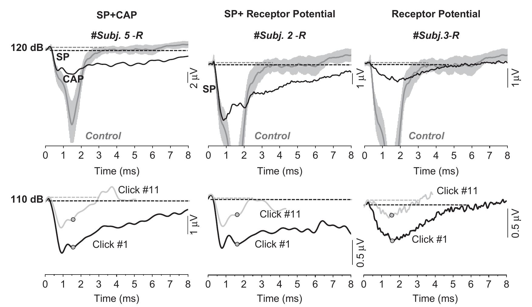 (PDF) Presynaptic and postsynaptic mechanisms underlying auditory ...