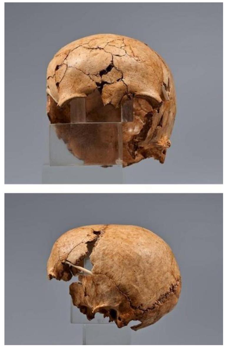 Supplementary Figure 10. Katre Street N° 1 (XAN036). The human skull reconstituted. 