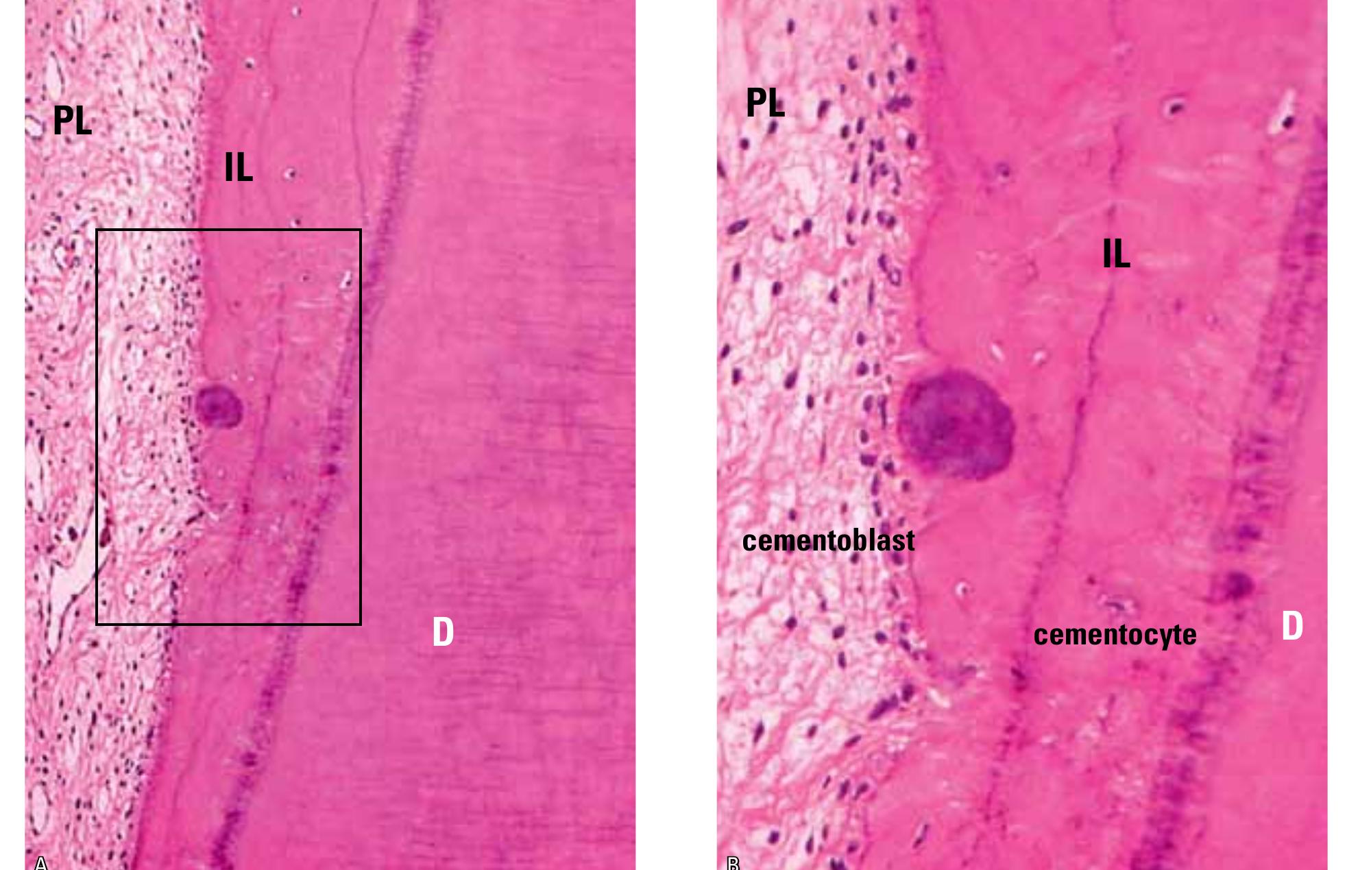 (PDF) Cementum, apical morphology and hypercementosis: a probable ...