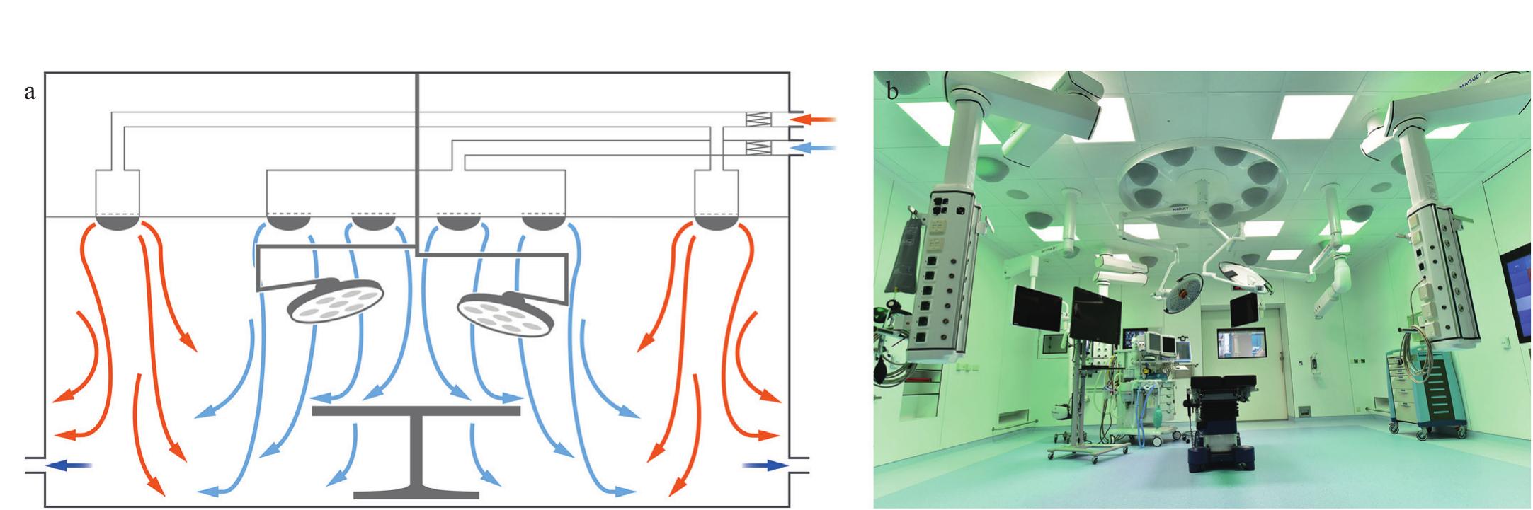 (PDF) Operating room ventilation systems: recovery degree, cleanliness ...