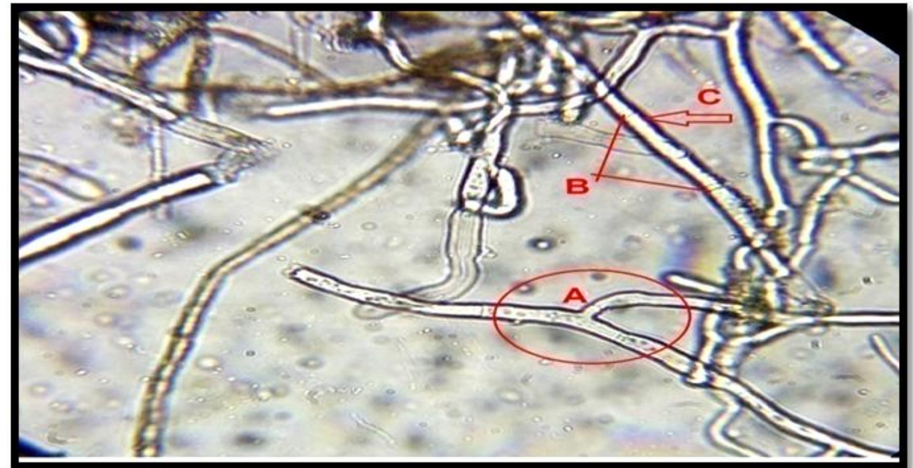 (PDF) Pathogenicity Test and Anastomosis Group of Rhizoctonia solani ...