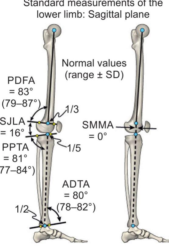 (PDF) Sagittal Plane Assessment in Deformity Correction Planning: The ...