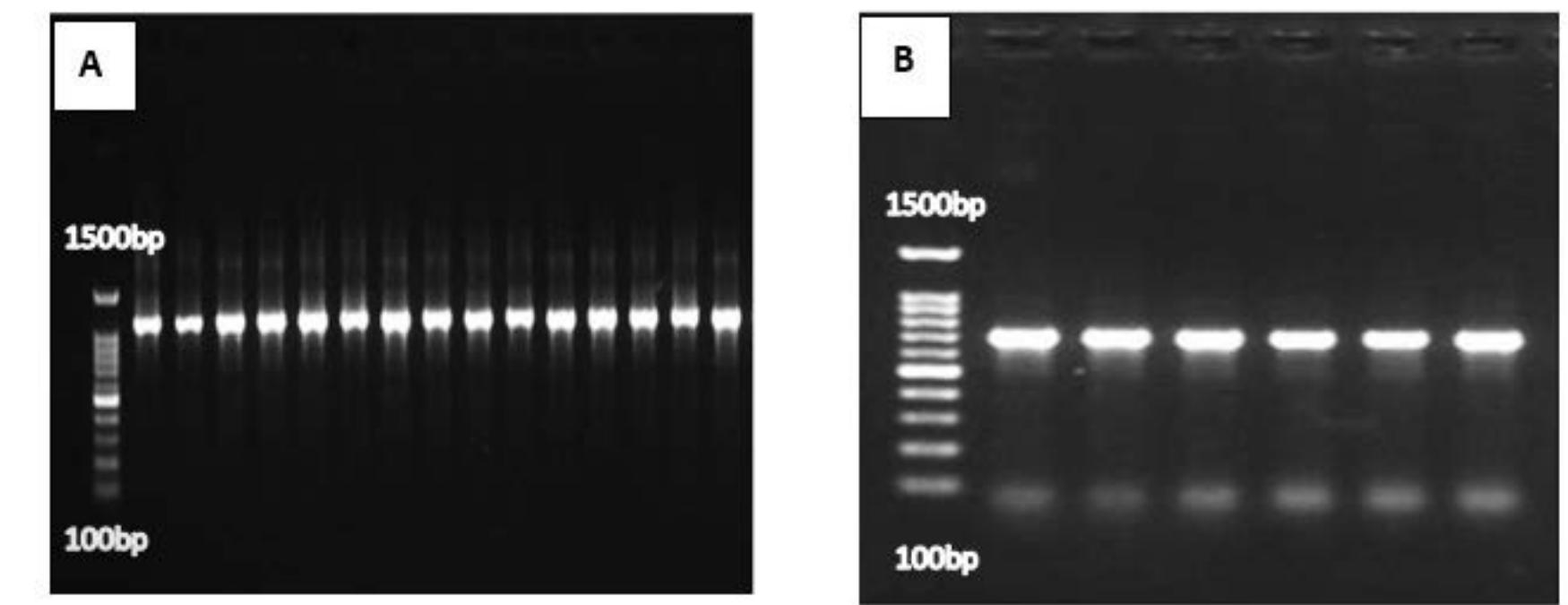 Agarose gel electrophoresis of pcr products of (a) 16s rrna