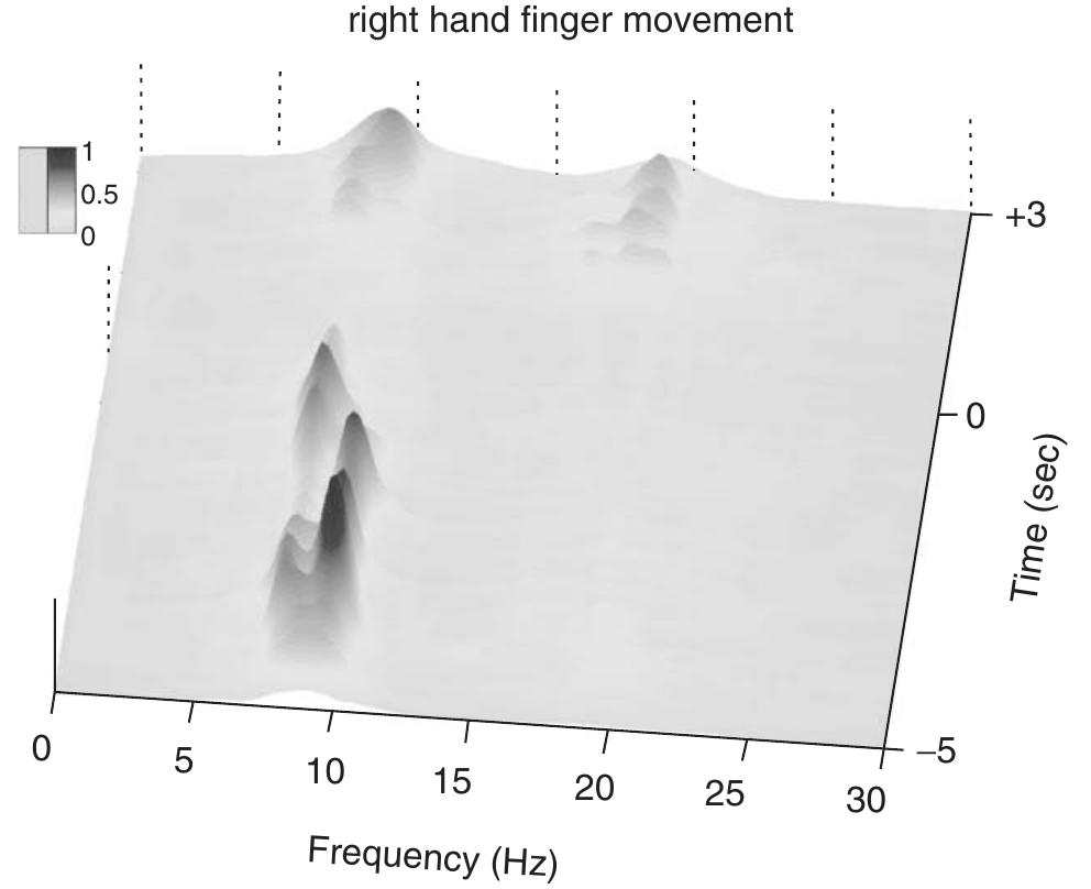 (PDF) Electroencephalography (EEG)