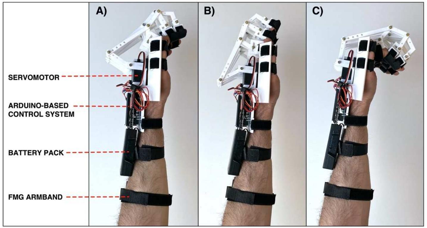 (PDF) Design of a 3D-Printed Hand Exoskeleton Based on Force-Myography ...