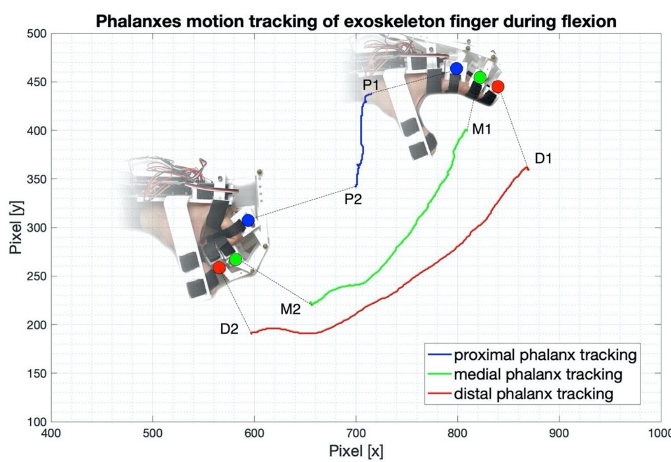 Excursion Flexion (PDF) Design of a 3D-Printed Hand Exoskeleton Based on Force-Myography ...