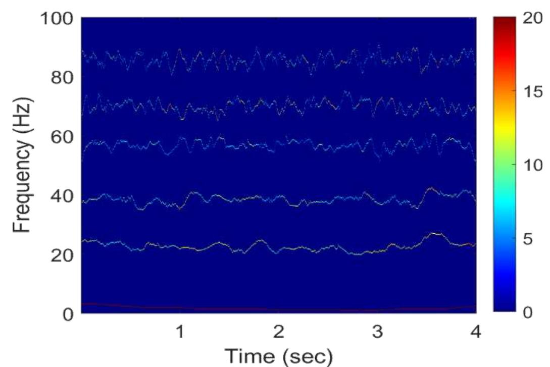 (PDF) Emotion detection using EEG signals based on Multivariate ...