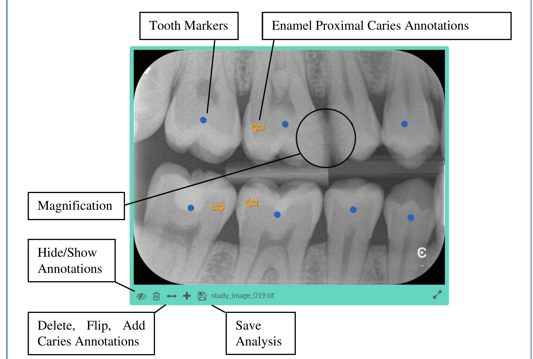 (PDF) A Pilot Comparative Study of Dental Students’ Ability to Detect ...