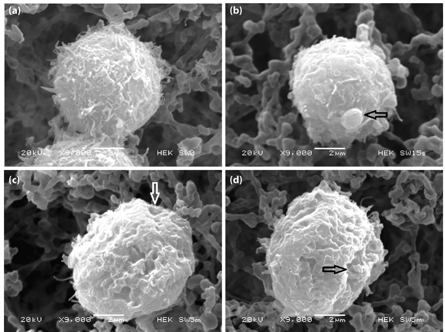 (PDF) Shock Wave-Induced Damage and Poration in Eukaryotic Cell Membranes