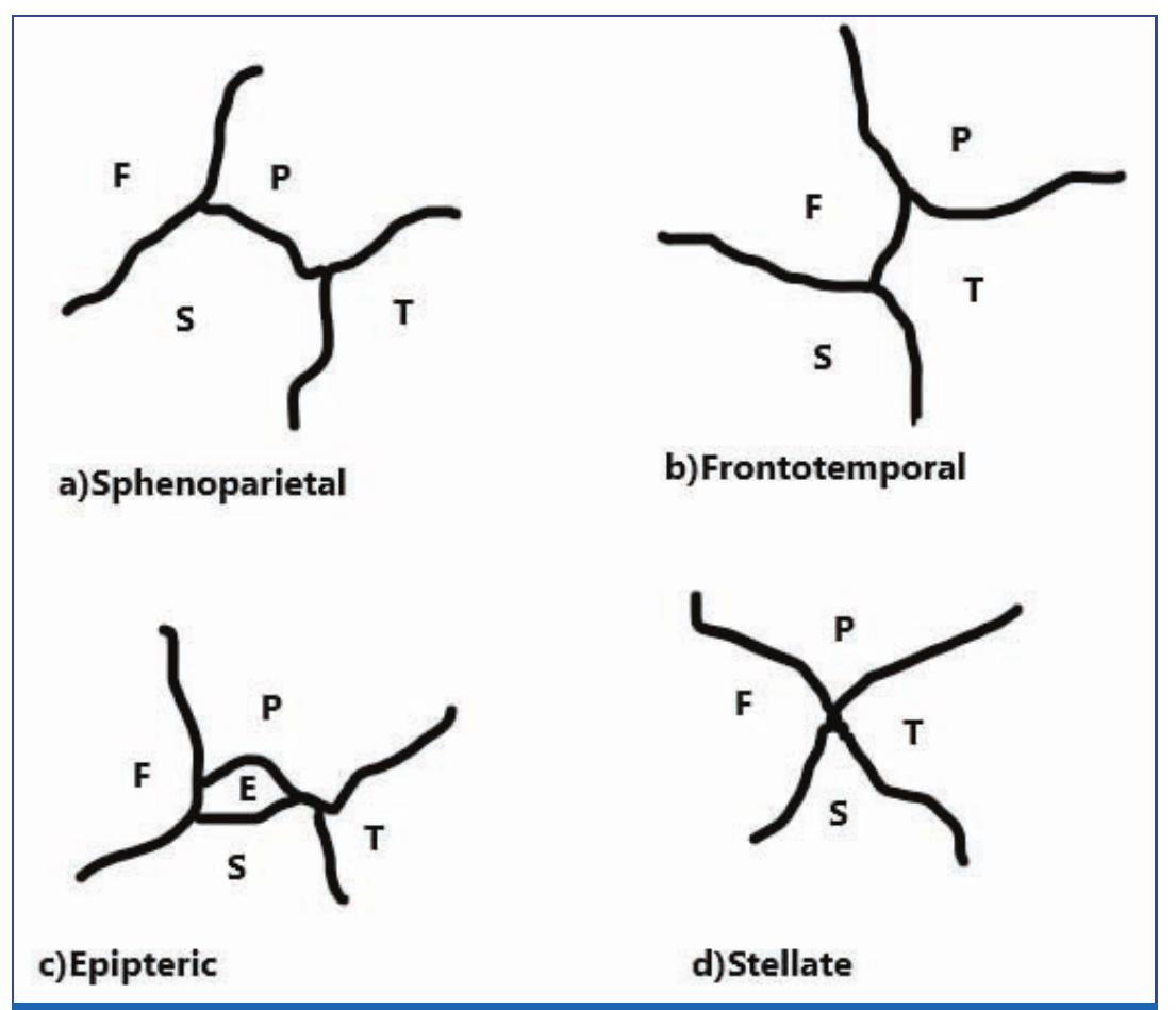 (PDF) A Cross-sectional Study on Morphology and Position of Pterion in ...