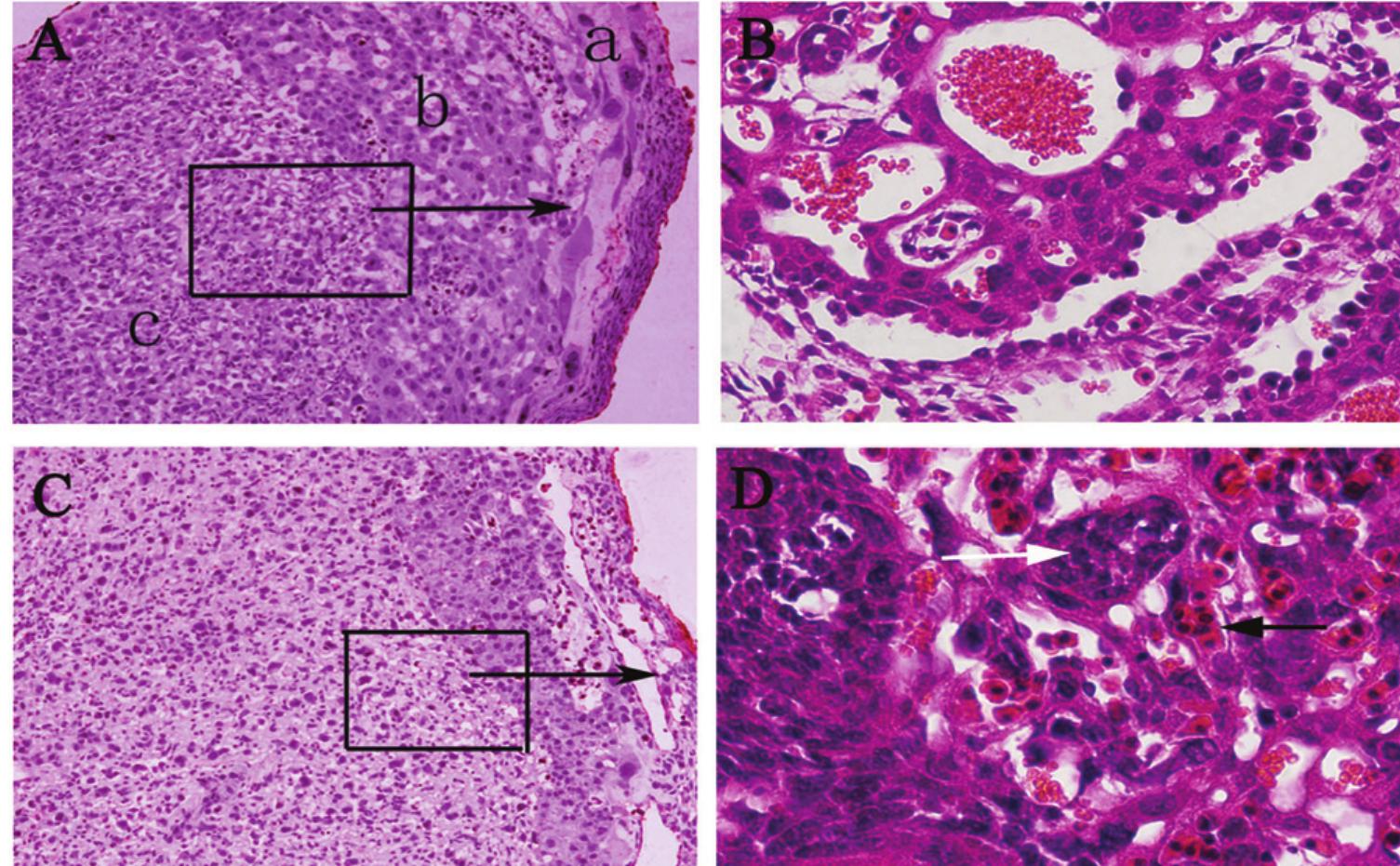 Pathology of placenta (hematoxylin and eosin stain) (a) the
