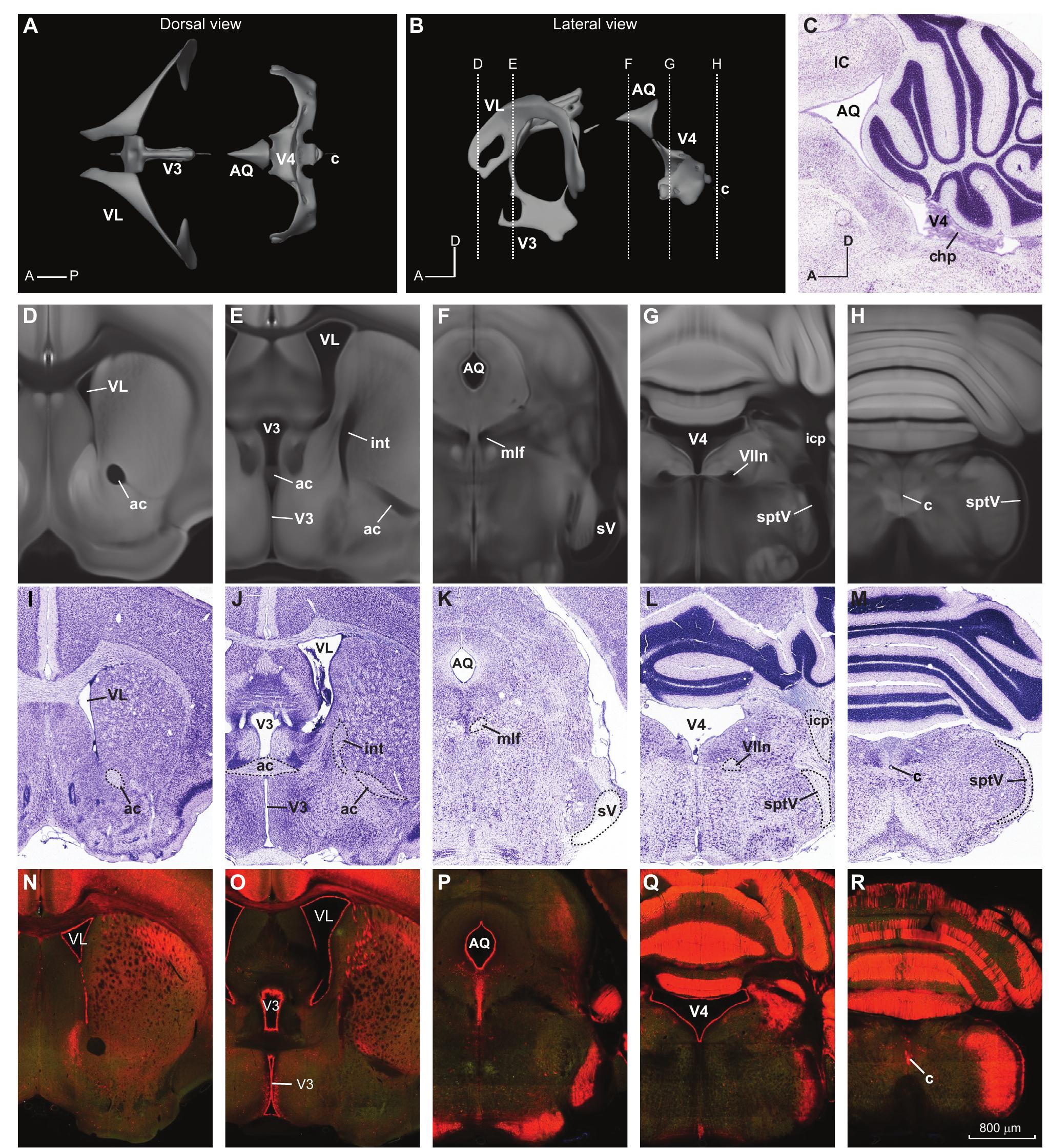 Figure 12 - The Allen Mouse Brain Common Coordinate