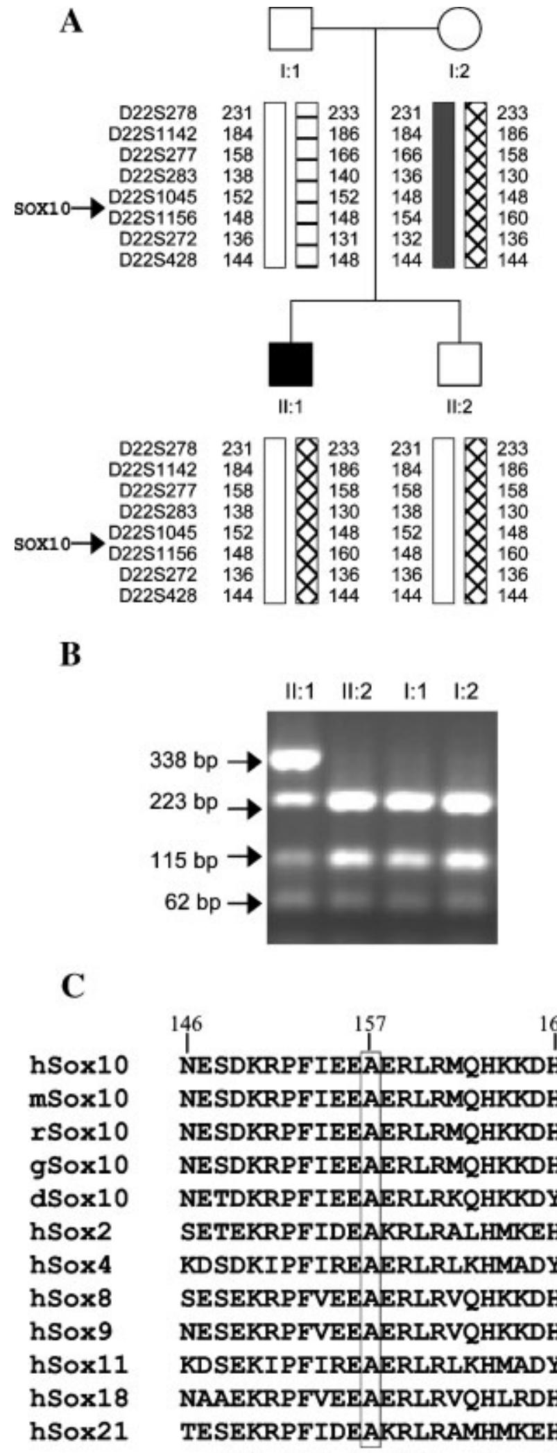 Figure 1 - from A de novo missense mutation in the gene