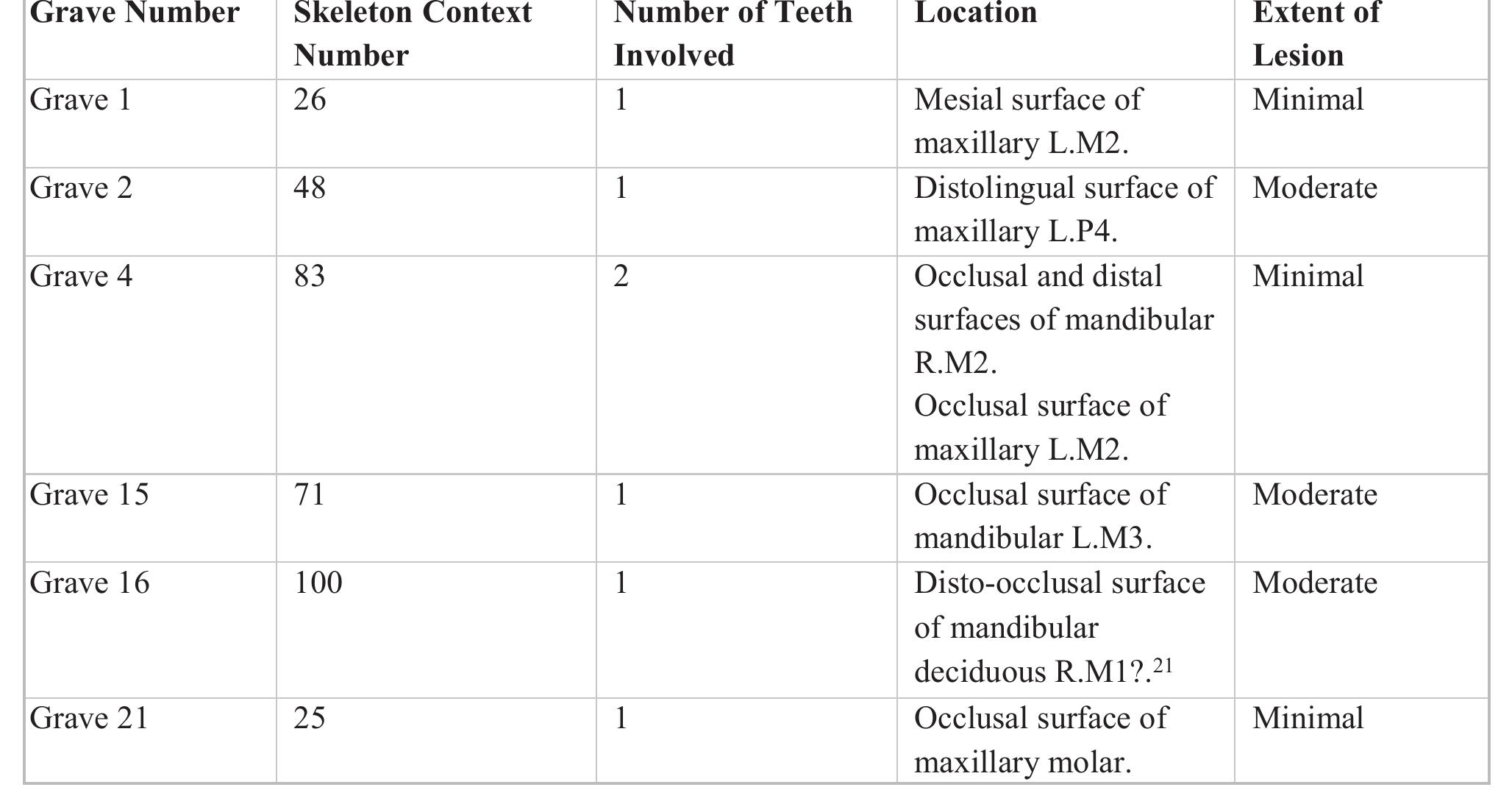 Tab. 9- Carious lesions observed in ASH 163.  Ante-mortem Tooth Loss (AMTL) was relatively  prevalent  in this assemblage (tab. 10). Although it  is not always possible to identify the exact cause of AMTL, the most significant factors involve dental decay, dental wear, and periodontal disease. Carious  lesions were observed on some of the remaining teeth in skeletons presenting AMTL (skeletons 25, 48, 83). It is therefore possible that the lost teeth were more  extensive  important role. Individuals such as skeleton 110 with highly worn teeth are subject to continuous tooth  eruption  Eventually, the over-eruption of a tooth results in its  falling ou  y decayed. Dental attrition also plays an  o make up for the functional surfaces lost.  . Periodontal disease, on the other hand, is  characterised by the resorption of the alveolar bone leading to the loosening of the teeth in the sockets. It is often caused by the build-up of calculus on the surfaces of the teeth, a condition not observed in this assemblage except with skeleton 48 that displayed  grooves was detected in three individuals (tab. 11) 
