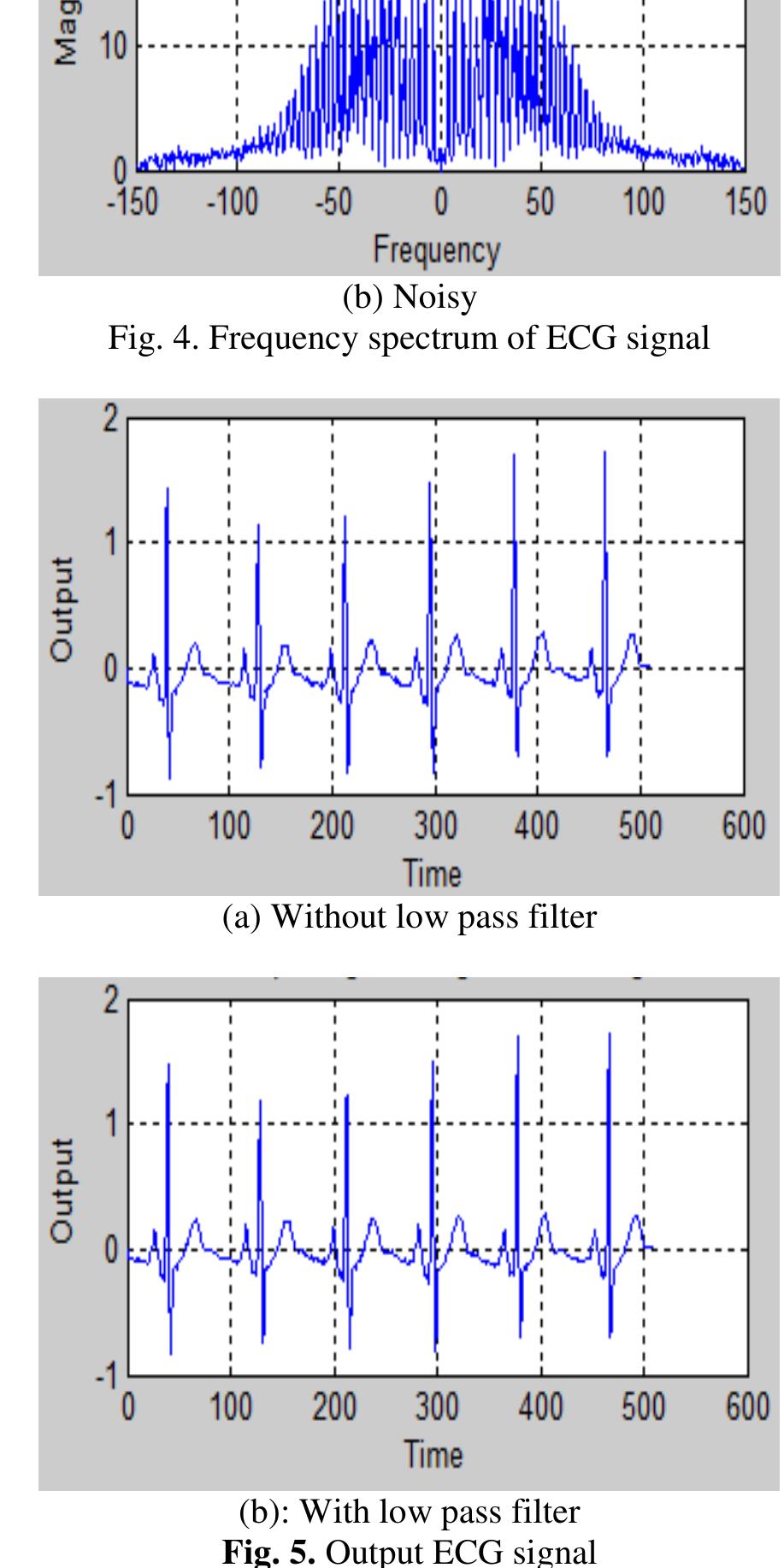 (PDF) Power Line Interference Removal from ECG Signal using Adaptive Filter