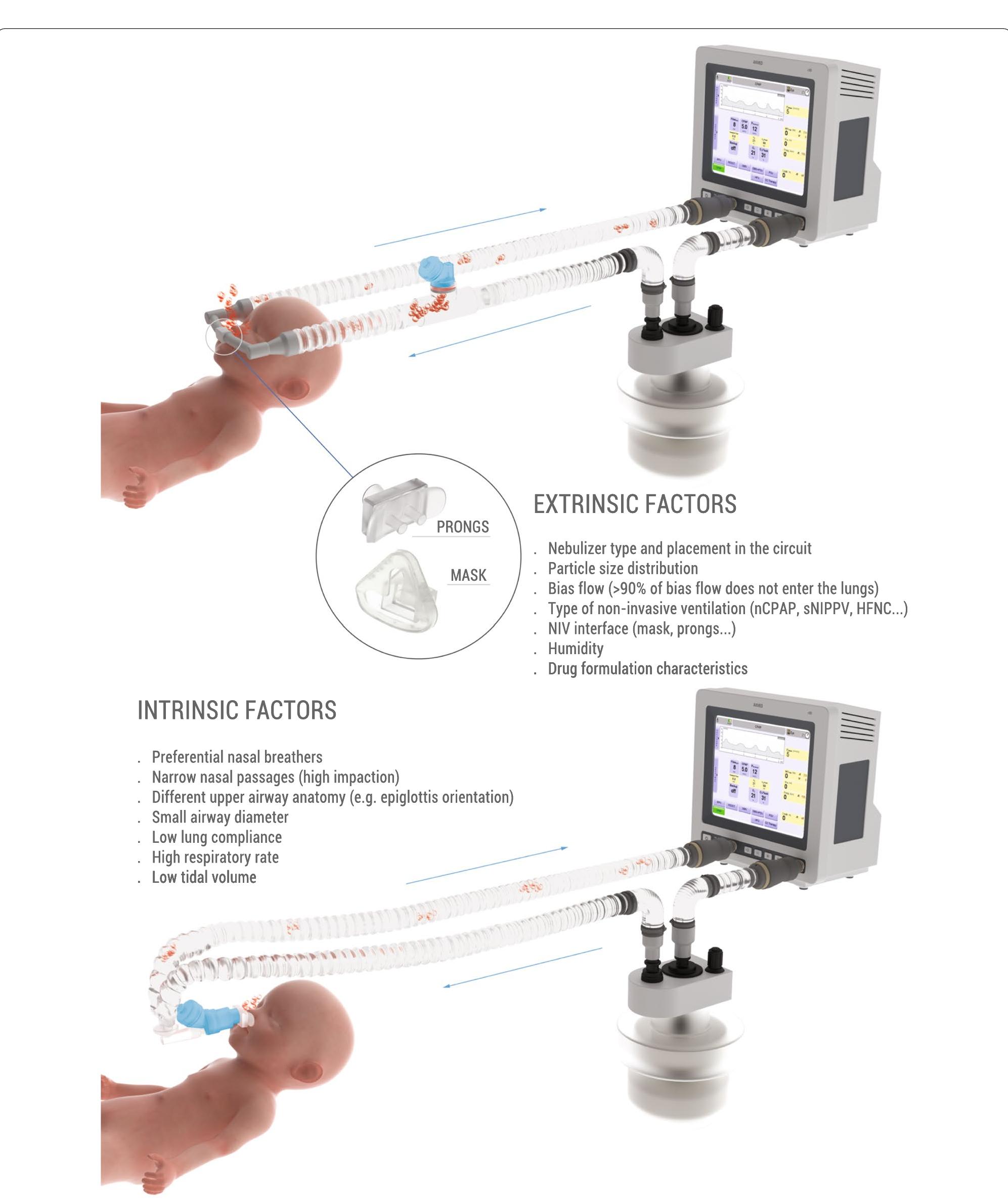 Scheme of an in vitro neonatal circuit for aerosol delivery