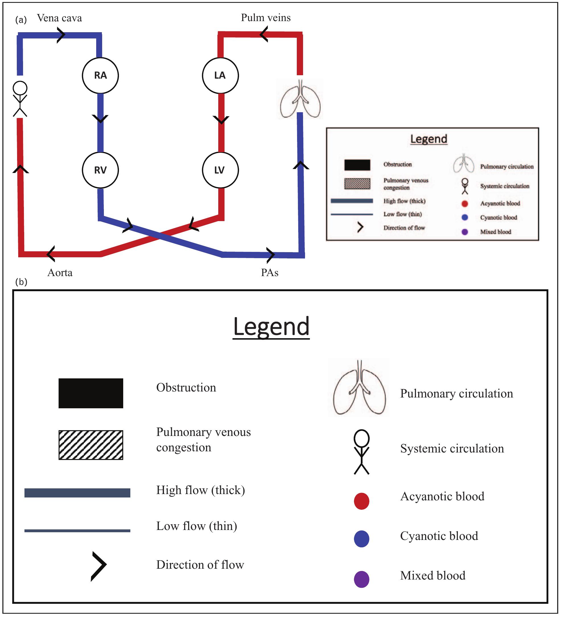 Normal neonatal circulation. (a) normal circulation consists