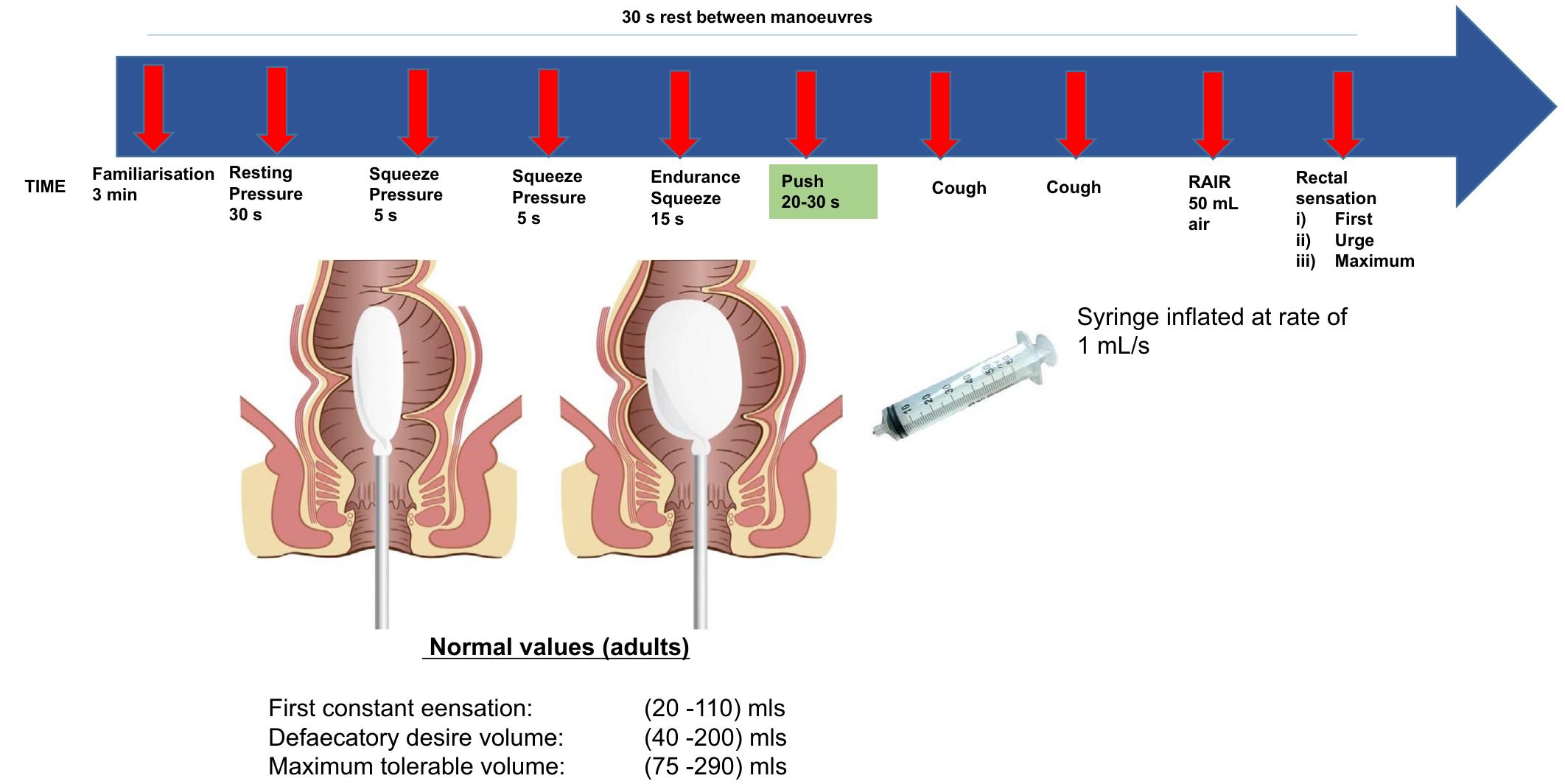 (PDF) Anorectal manometry in children with defecation disorders BSPGHAN ...