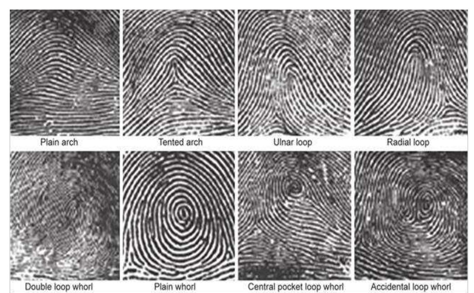 (PDF) A Study of Fingernail Plate Shape and Fingerprint Pattern among ...