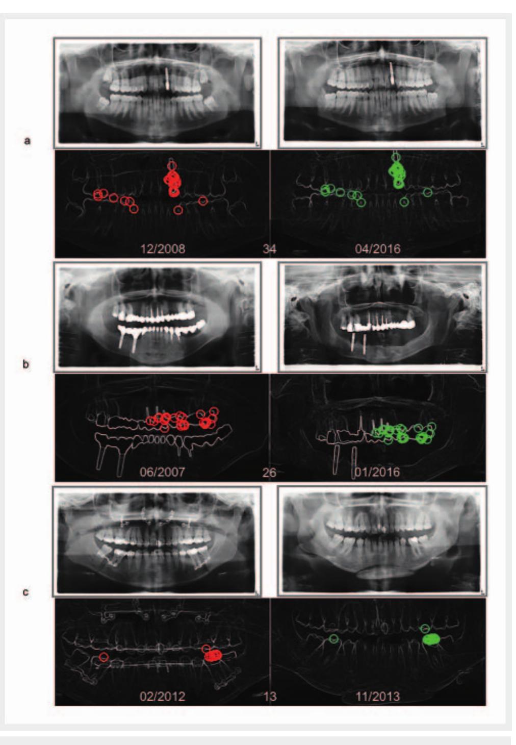 (PDF) Forensic Odontology: Automatic Identification of Persons ...