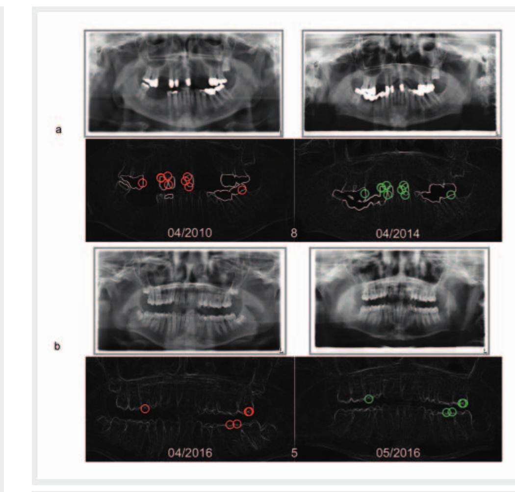 (PDF) Forensic Odontology: Automatic Identification of Persons ...